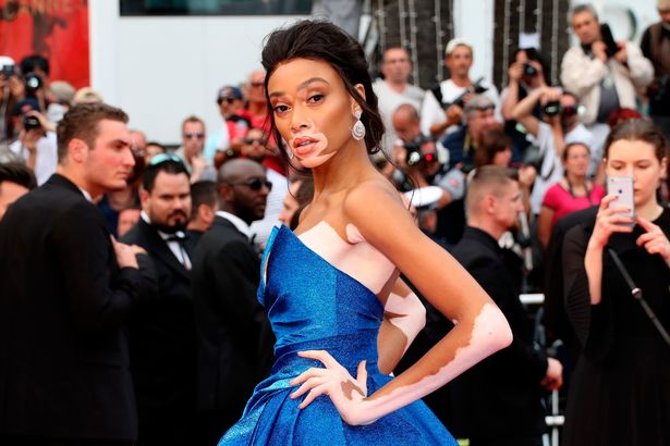 উইনি হার্লো