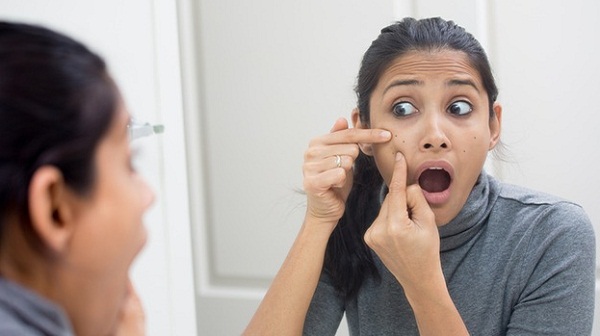 ব্রণের দাগ