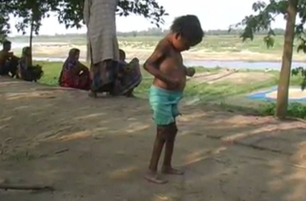 বিরল রোগ