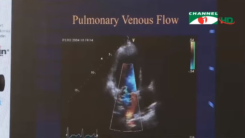 হৃদরোগ চিকিৎসায় বাংলাদেশের উন্নতি