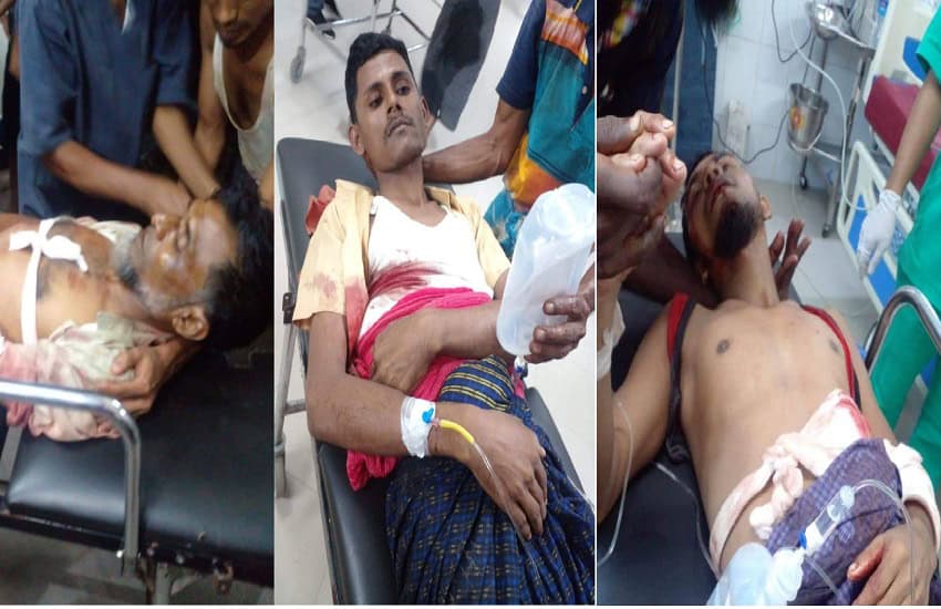 রোহিঙ্গা ক্যাম্পে আহত ব্যক্তিদের চিকিৎসা চলছে. Channel i News - চ্যানেল আই নিউজ
