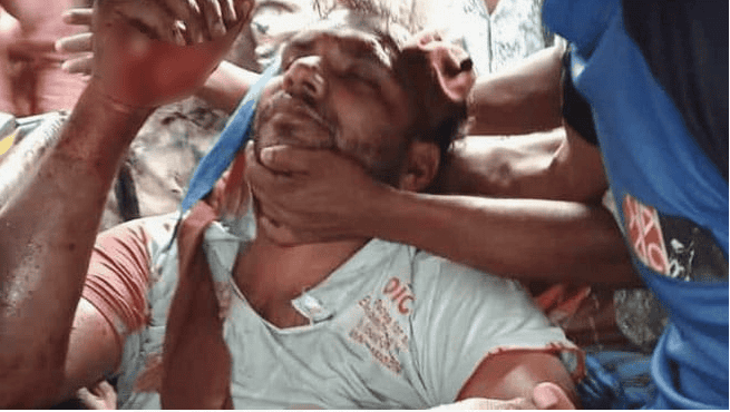 আহত ব্যক্তিকে উদ্ধার করতে স্থানীয়রা ব্যস্ত. Channel i News - চ্যানেল আই নিউজ