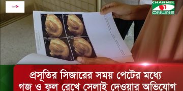 দিনাজপুরে এক প্রসূতির সিজারের সময় পেটের মধ্যে গজ ও ফুল রেখে সেলাই দেওয়ার অভিযোগ