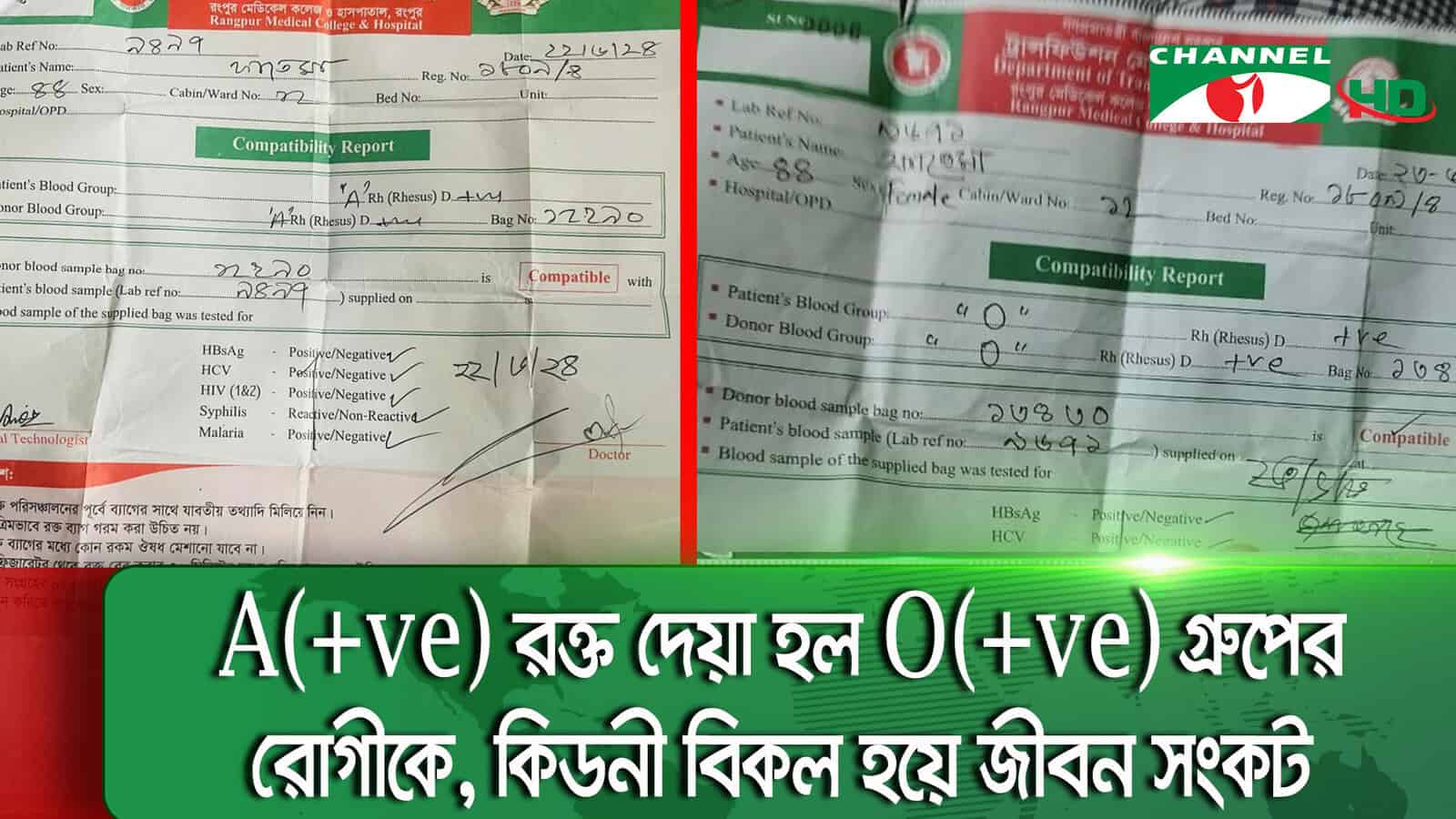রক্তের গ্রুপিংয়ে ভুল করল রংপুর মেডিকেল কলেজ হাসপাতাল | চ্যানেল আই অনলাইন