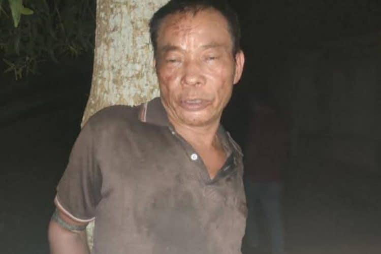 অভিযুক্ত ব্যক্তি আহত অবস্থায়, কক্সবাজারে হত্যাকাণ্ডের ঘটনাস্থল।. Channel i News - চ্যানেল আই নিউজ