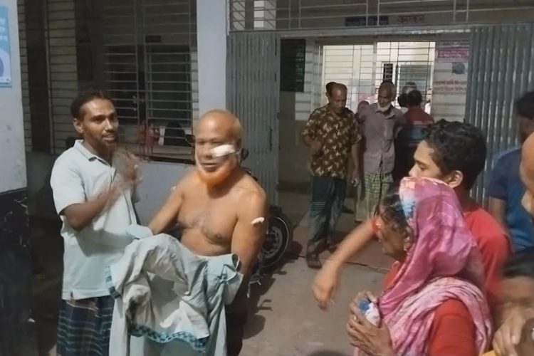 শিয়ালের কামড়ে আহত ব্যক্তি স্বাস্থ্য কেন্দ্রে চিকিৎসা নেন।