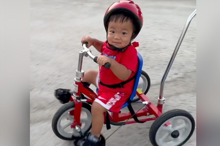 হান্টার সিনড্রোম বা এমপিএস–II নামে বিরল রোগে আক্রান্ত শিশু অলিভার। ছবি: বিবিসি