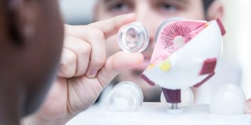 মায়োপিয়ার চিকিৎসা প্রযুক্তি উদ্ভাবন