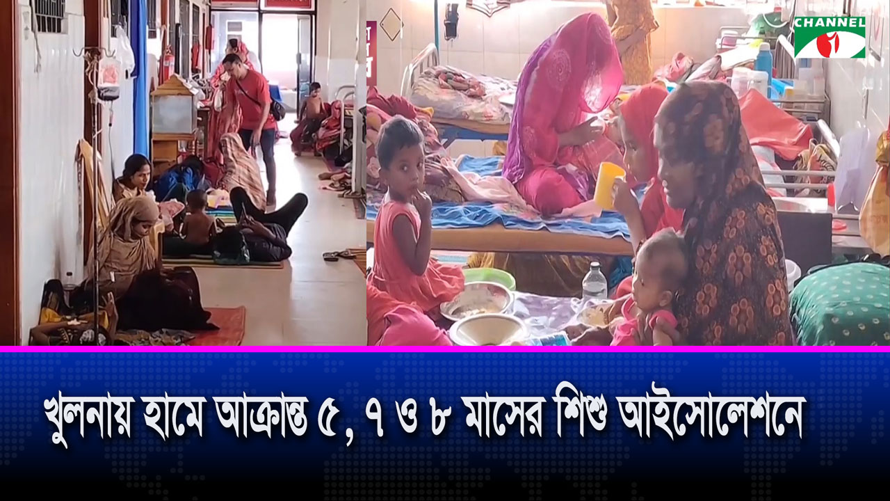 সারা দেশে হামের সংক্রমণ বাড়ছেই