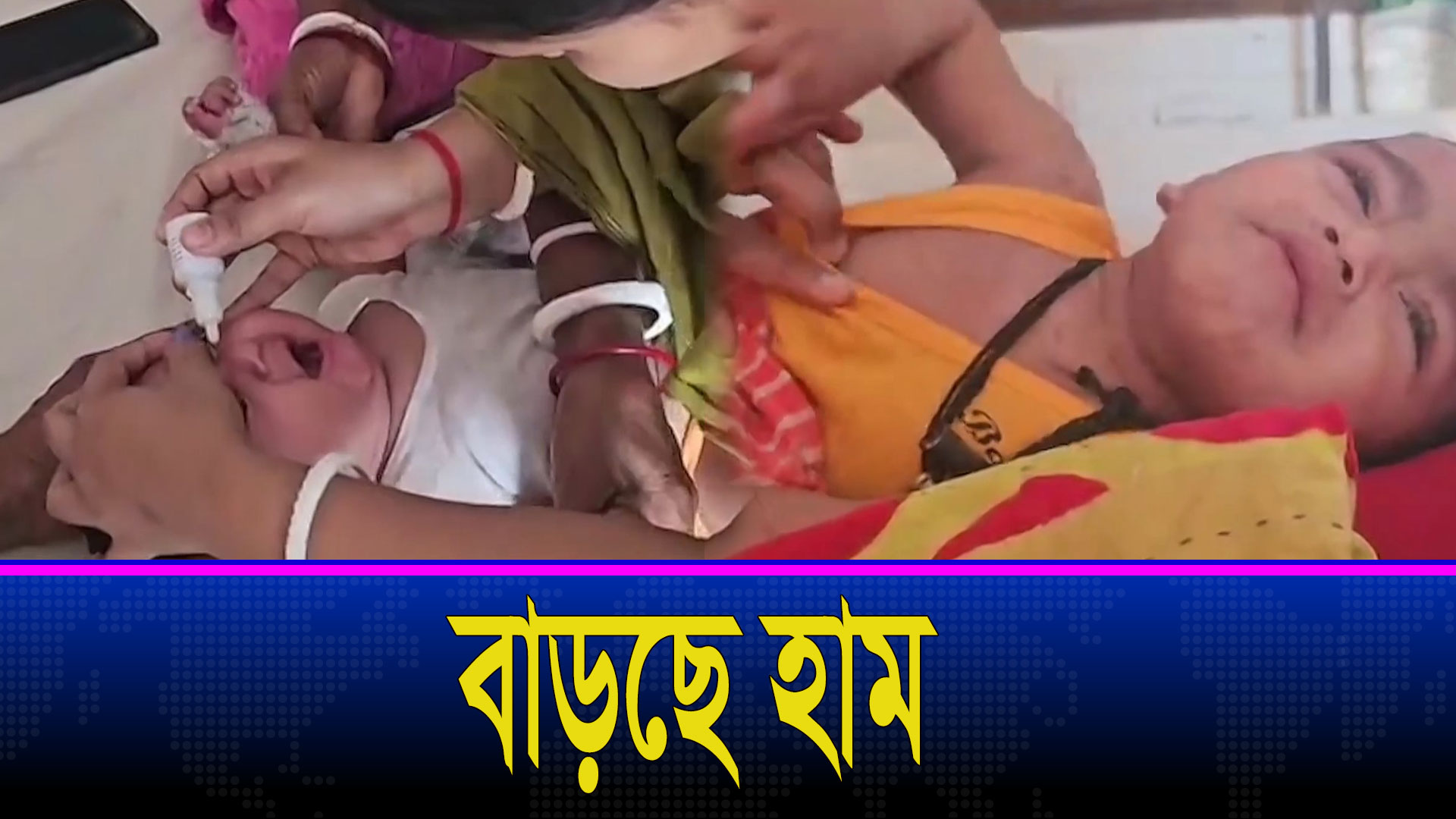 দেশের বিভিন্ন অঞ্চলে হামের প্রাদুর্ভাব বাড়ছে