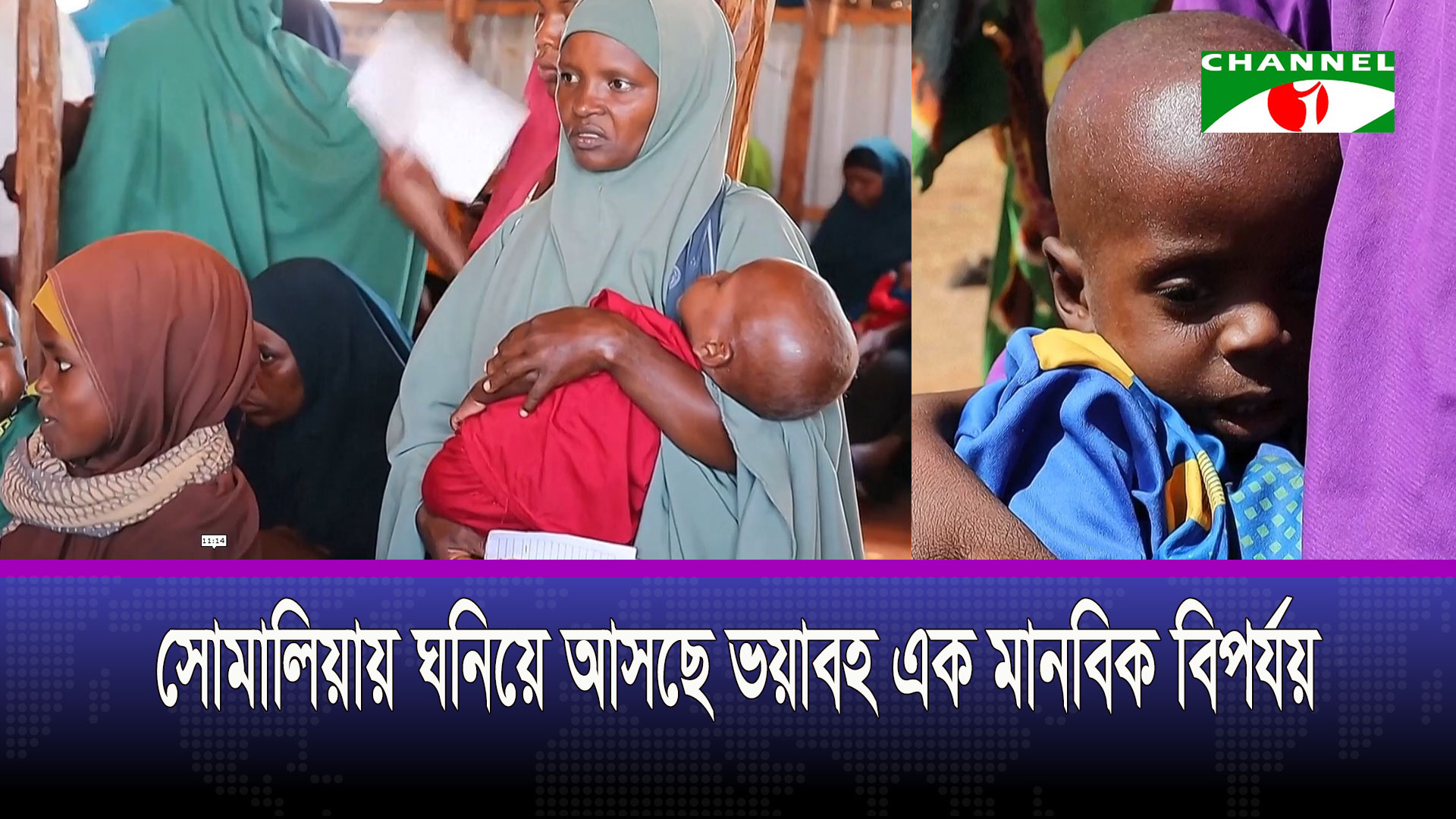 ২০২৬ সালের মধ্যে প্রায় সাড়ে ১৮ লাখ শিশু চরম অপুষ্টির শিকার হতে পারে: ইউনিসেফ