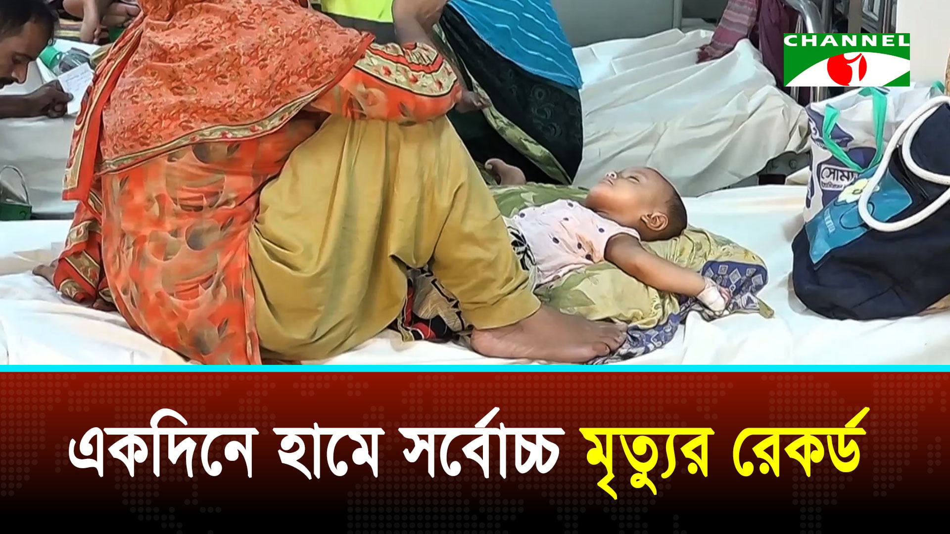 হামের উপসর্গ নিয়ে গত ২৪ ঘণ্টায় ১৭ শিশুর মৃত্যু
