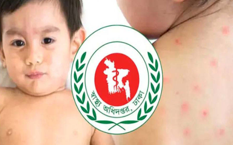হামে আরও ২ শিশুর মৃত্যু | চ্যানেল আই অনলাইন হামে আরও ২ শিশুর মৃত্যু | চ্যানেল আই অনলাইন
